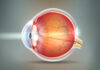 THE EYE CONDITION OF HAVING CATARACTS Cataracts abstract grey background