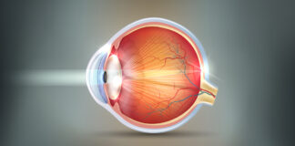 THE EYE CONDITION OF HAVING CATARACTS Cataracts abstract grey background