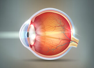 THE EYE CONDITION OF HAVING CATARACTS Cataracts abstract grey background